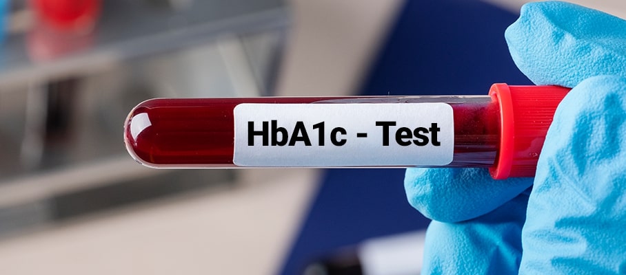 Importance, Range And Target of HbA1c Test