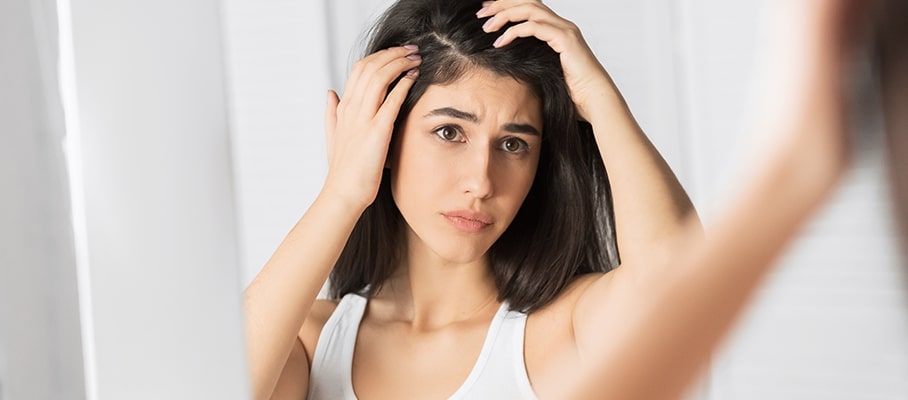 Home Remedies To Cure Dandruff Naturally