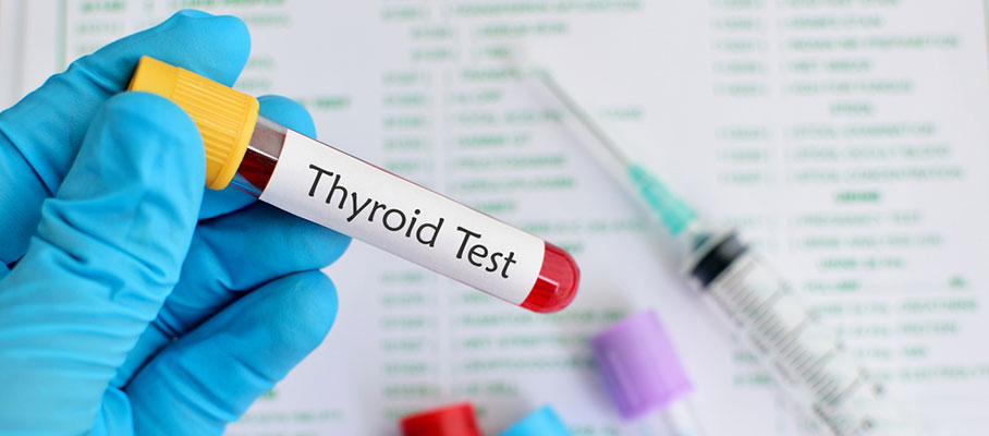 Thyroid Test and Types