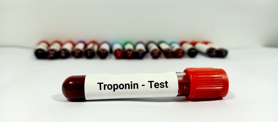 Troponin Test and Normal Range