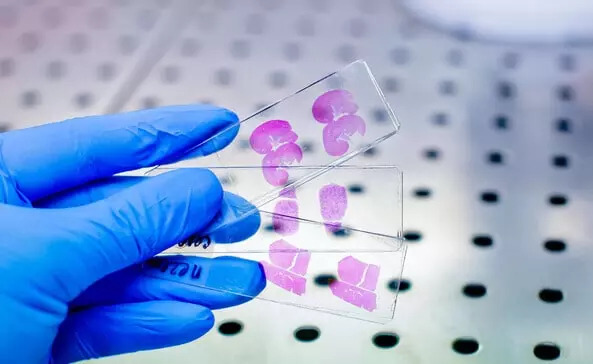 IHC Test and Procedure