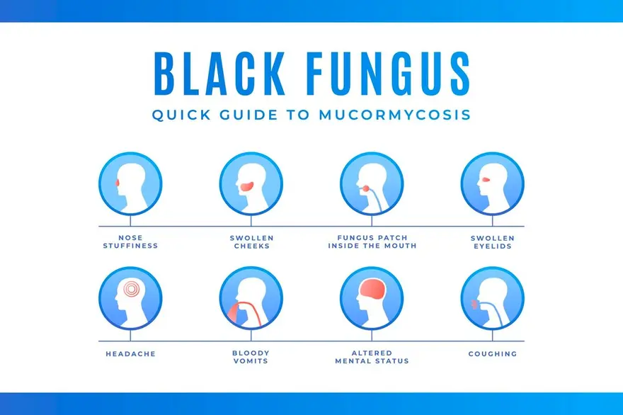 Mucormycosis and Black Fungus