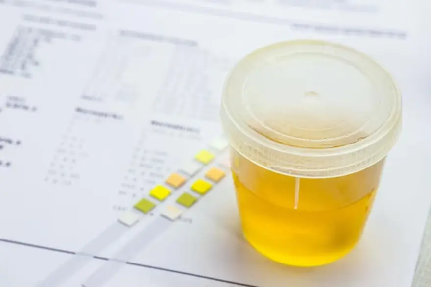 Urinalysis and Normal Range