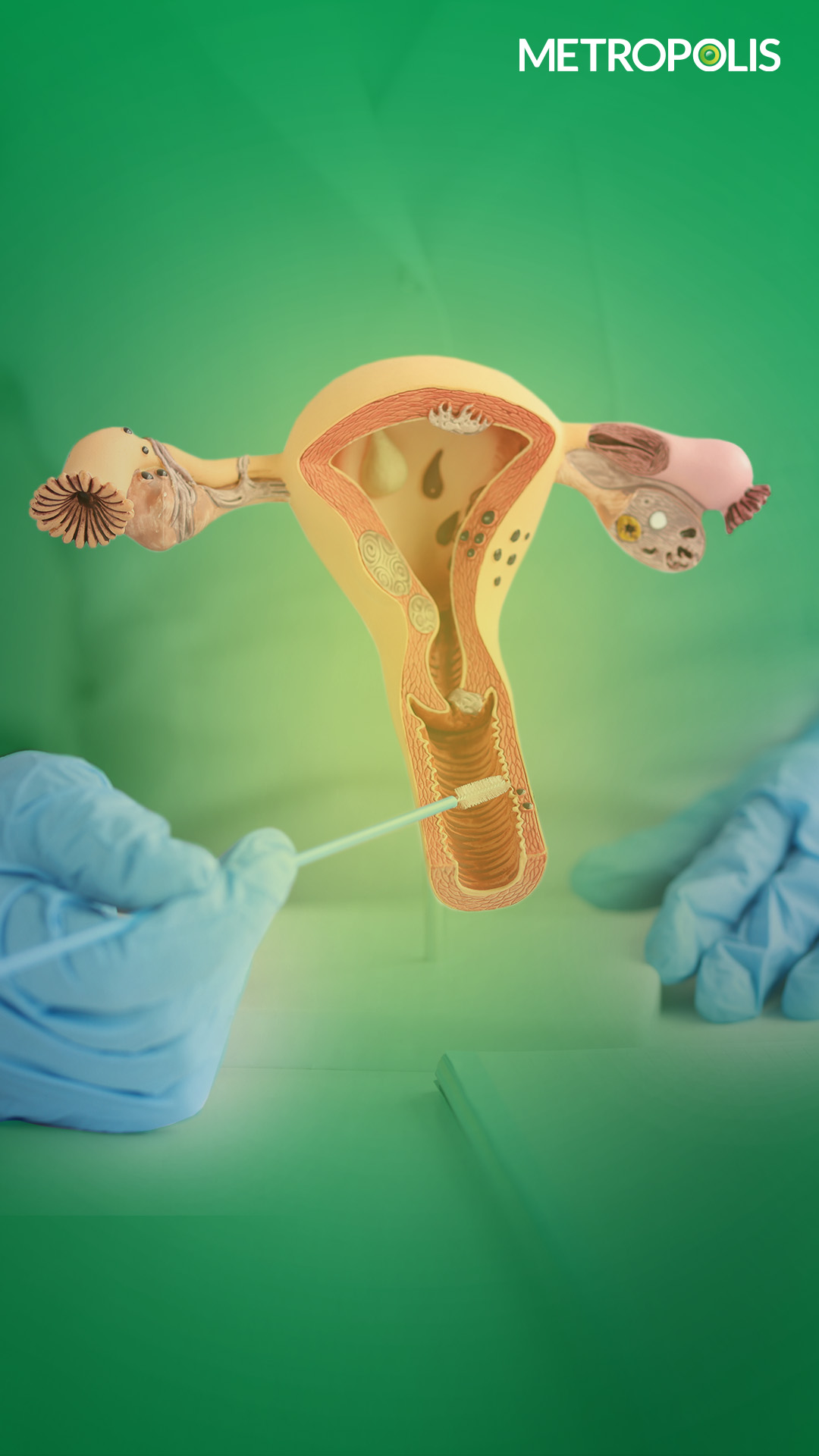 Stay Informed About Cervical Cancer