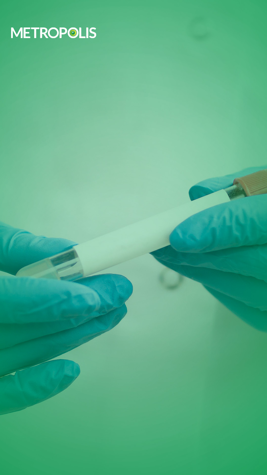 Tryptase Test for allergies