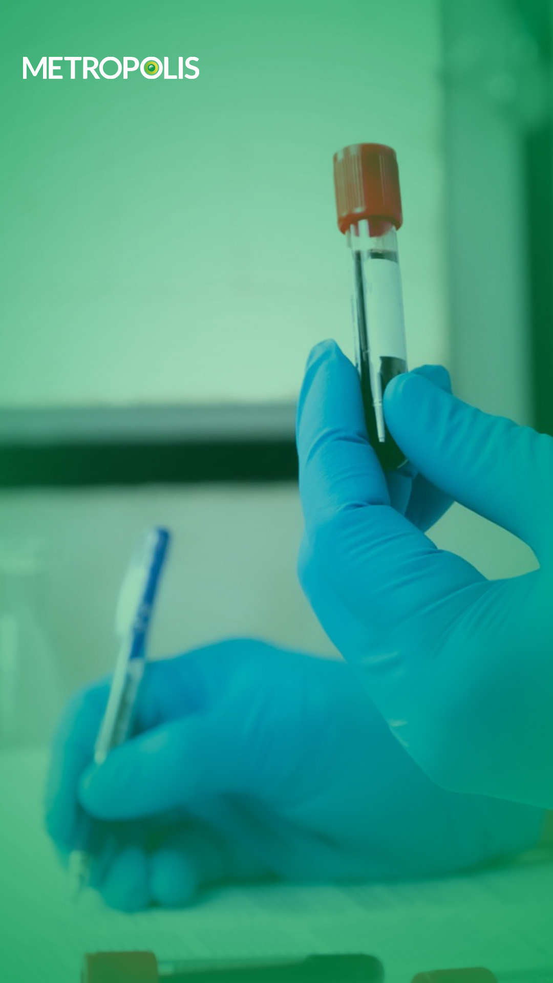 Postprandial blood sugar (PPBS) Test