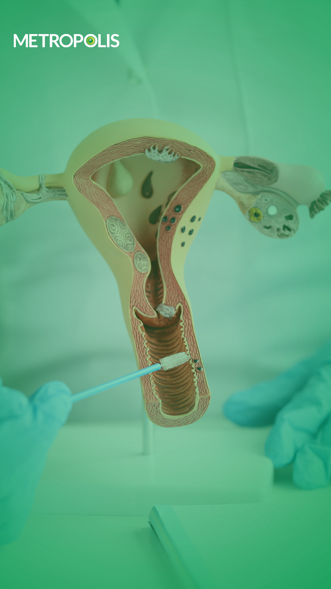 Stay Informed about cervical cancer