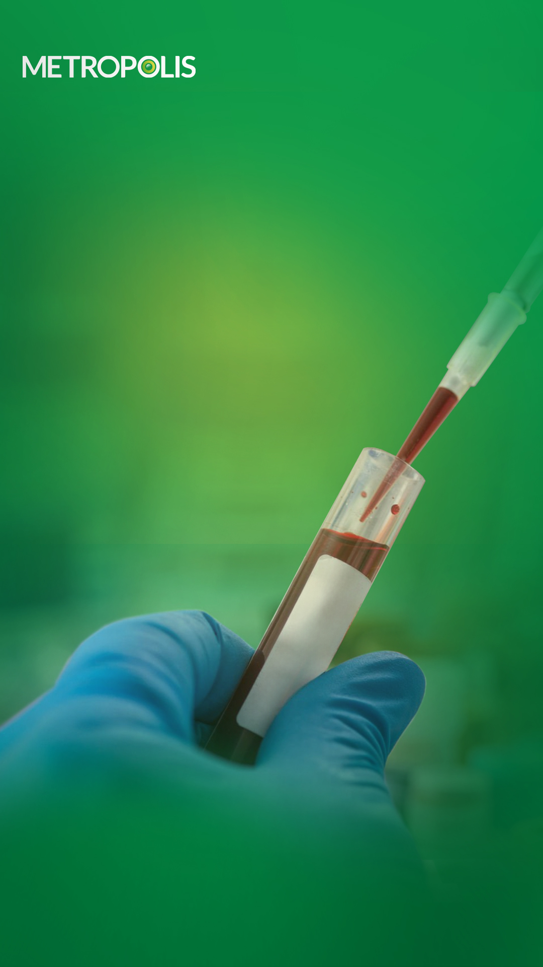 What in your c-peptide test results