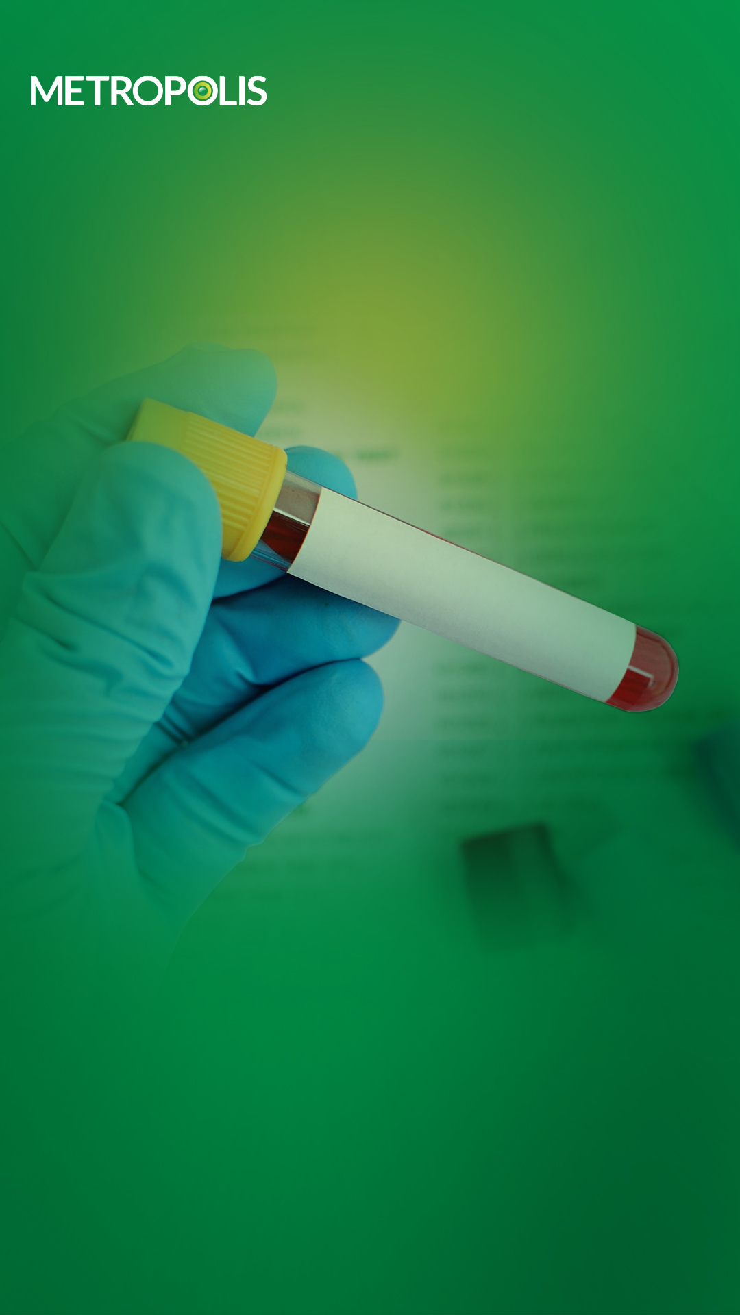 Fasting blood glucose (FBS) test