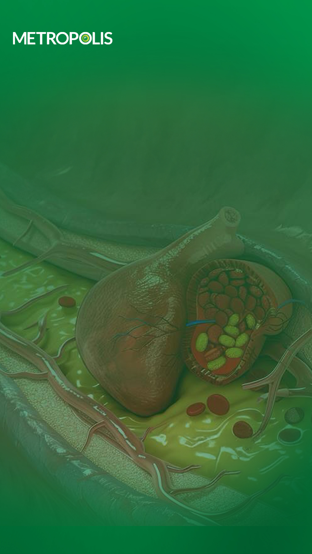 Yellow bumps on your skin Can be a sign of dyslipidemia!